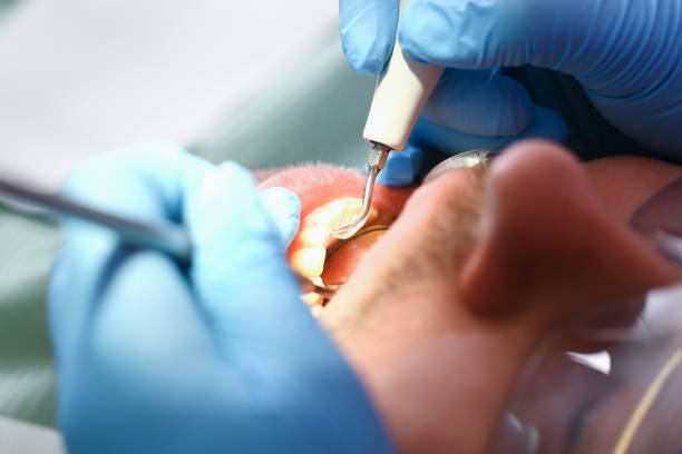 Best Urgent Care for Lost Fillings or Crowns in Mustang, OK