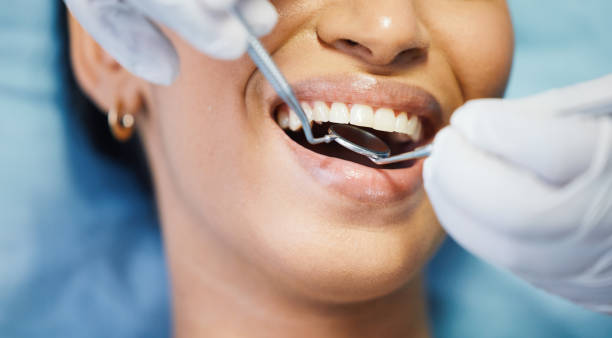 Best Urgent Care for Lost Fillings or Crowns in Mustang, OK